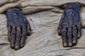 acidificazione del corpo - benedetta balistica