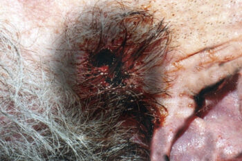 Riconoscere un Foro di Ingresso_ Guida Forense alle Caratteristiche Distintive